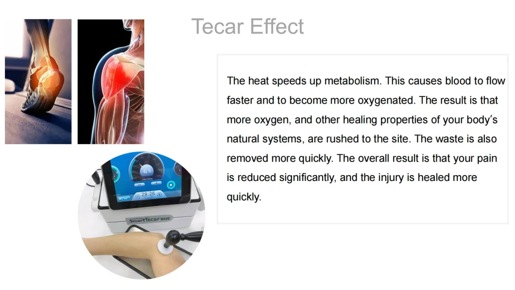 Smart Cet Ret Tecar Wave Physical Therapy Machine Combines Electromagetic Shockwave EMS Electric Muscle Stimulation